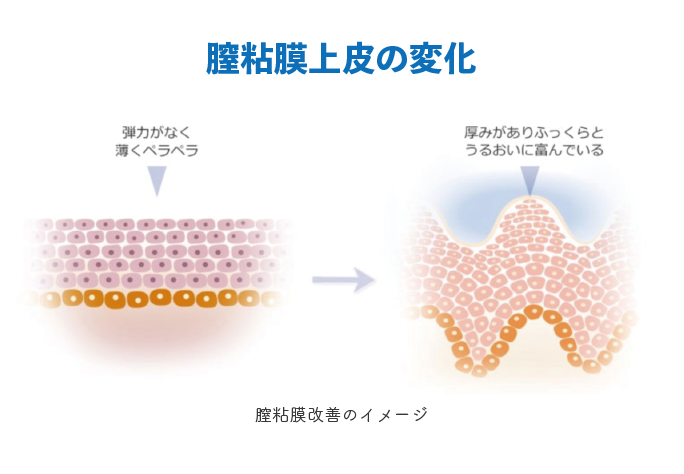 薄くなった膣粘膜を若く再生させます