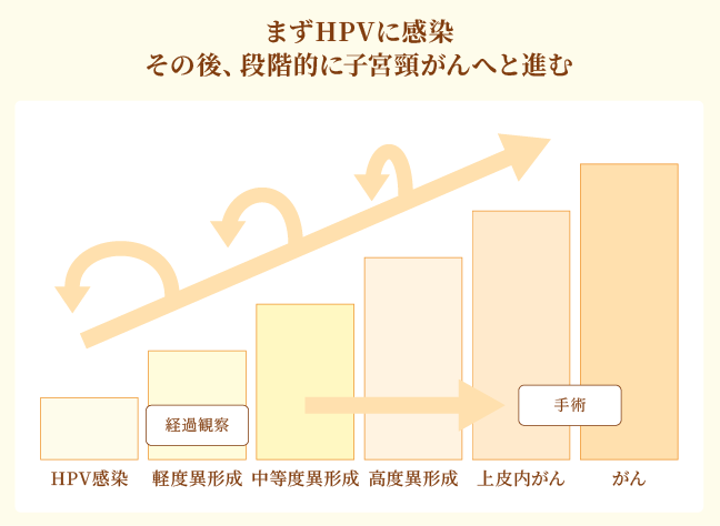 子宮頸がんの原因と成り立ち